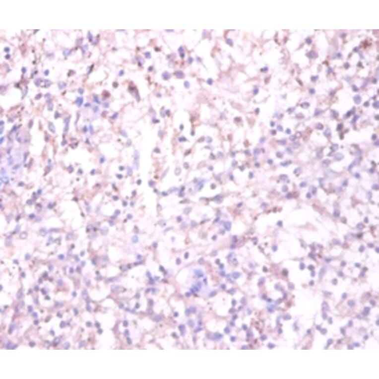 Immunohistochemistry - Substance-P receptor Polyclonal Antibody from Signalway Antibody (42508) - Antibodies.com