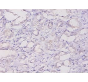 Immunohistochemistry - Ferritin light chain Polyclonal Antibody from Signalway Antibody (42538) - Antibodies.com