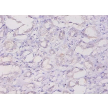 Immunohistochemistry - Ferritin light chain Polyclonal Antibody from Signalway Antibody (42538) - Antibodies.com