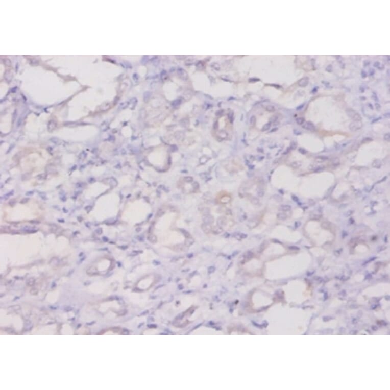 Immunohistochemistry - Ferritin light chain Polyclonal Antibody from Signalway Antibody (42538) - Antibodies.com