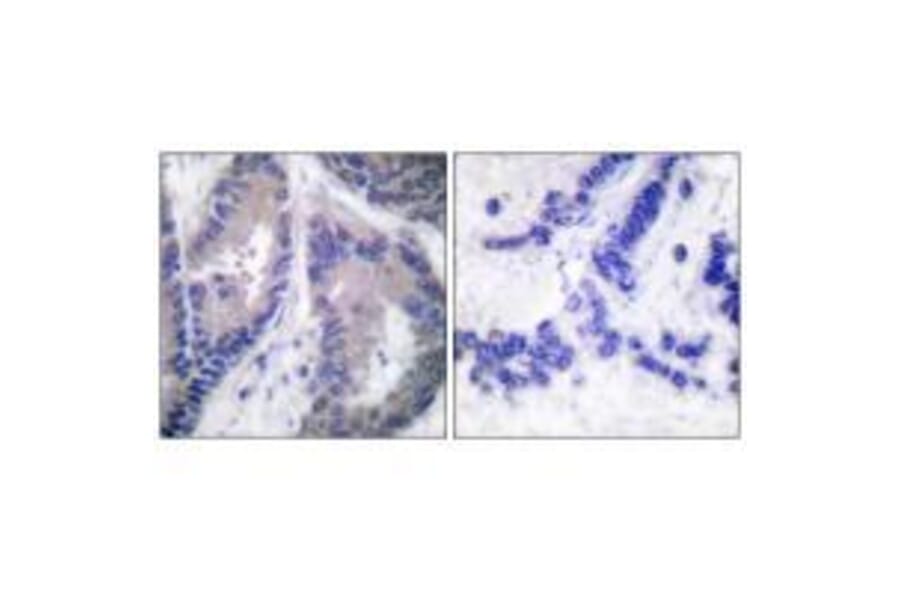 Immunohistochemistry - Endostatin Antibody from Signalway Antibody (33363) - Antibodies.com