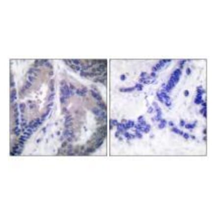 Immunohistochemistry - Endostatin Antibody from Signalway Antibody (33363) - Antibodies.com
