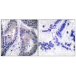 Immunohistochemistry - Endostatin Antibody from Signalway Antibody (33363) - Antibodies.com