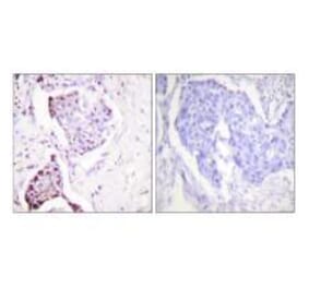 Immunohistochemistry - Ubiquitin Antibody from Signalway Antibody (33537) - Antibodies.com