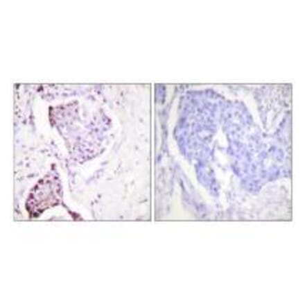 Immunohistochemistry - Ubiquitin Antibody from Signalway Antibody (33537) - Antibodies.com