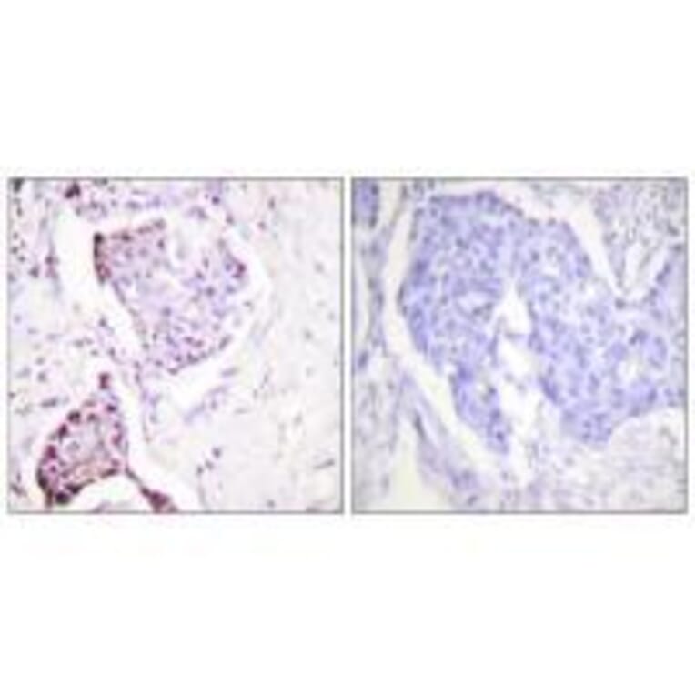 Immunohistochemistry - Ubiquitin Antibody from Signalway Antibody (33537) - Antibodies.com