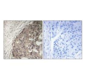 Immunohistochemistry - CSGALNACT1 Antibody from Signalway Antibody (34585) - Antibodies.com