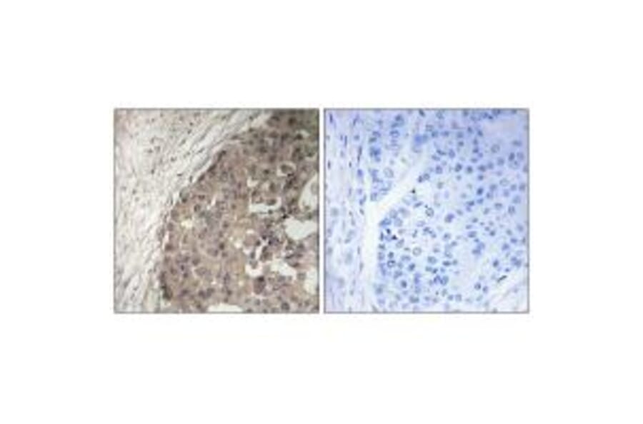 Immunohistochemistry - CSGALNACT1 Antibody from Signalway Antibody (34585) - Antibodies.com
