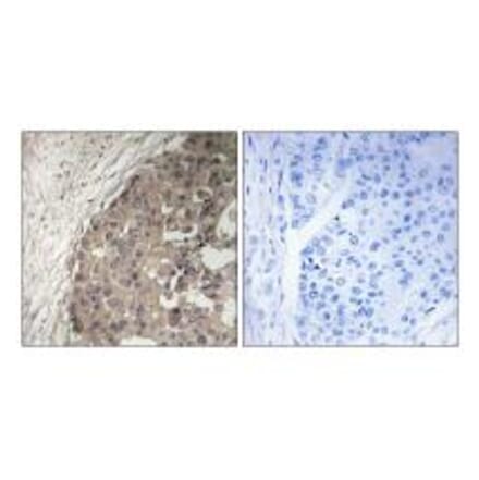 Immunohistochemistry - CSGALNACT1 Antibody from Signalway Antibody (34585) - Antibodies.com