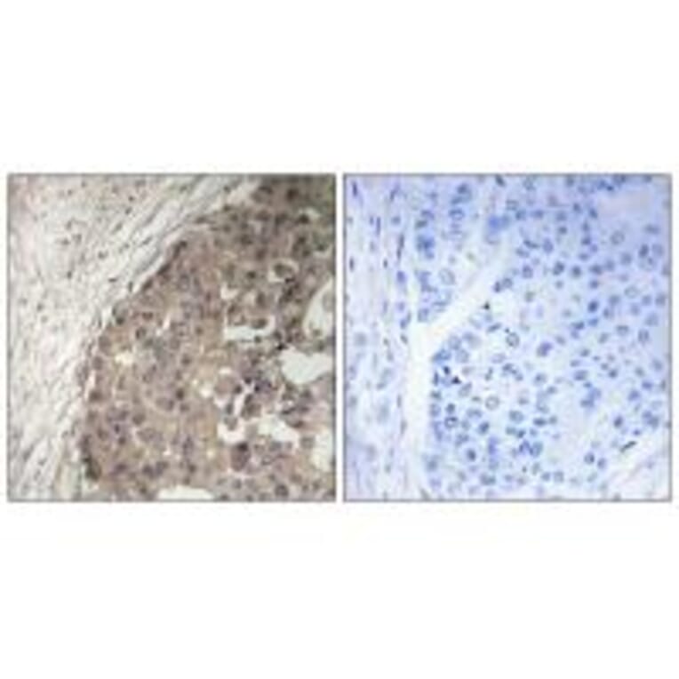 Immunohistochemistry - CSGALNACT1 Antibody from Signalway Antibody (34585) - Antibodies.com