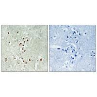 Immunohistochemistry analysis of paraffin-embedded human brain tissue using GADD45GIP1 antibody #34708.