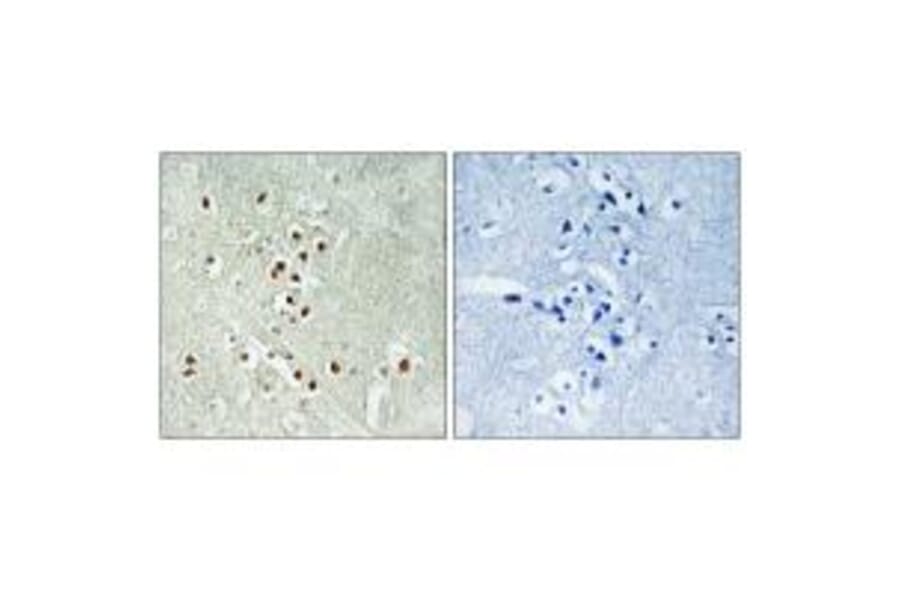 Immunohistochemistry - GADD45GIP1 Antibody from Signalway Antibody (34708) - Antibodies.com