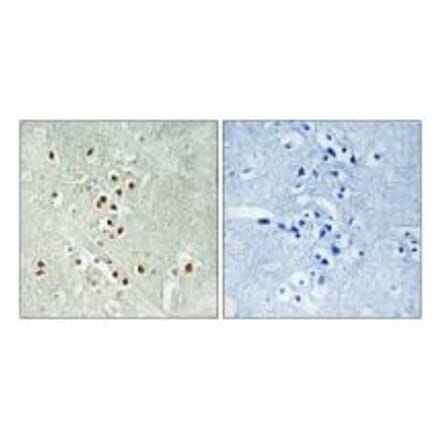 Immunohistochemistry - GADD45GIP1 Antibody from Signalway Antibody (34708) - Antibodies.com