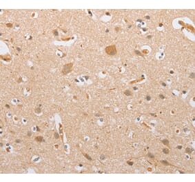 Immunohistochemistry - CSGALNACT2 Antibody from Signalway Antibody (36215) - Antibodies.com