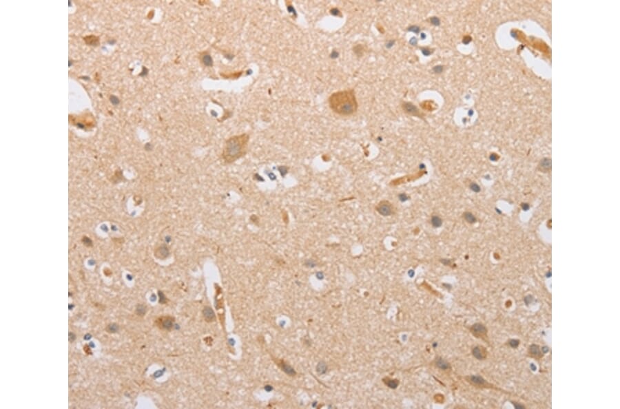 Immunohistochemistry - CSGALNACT2 Antibody from Signalway Antibody (36215) - Antibodies.com