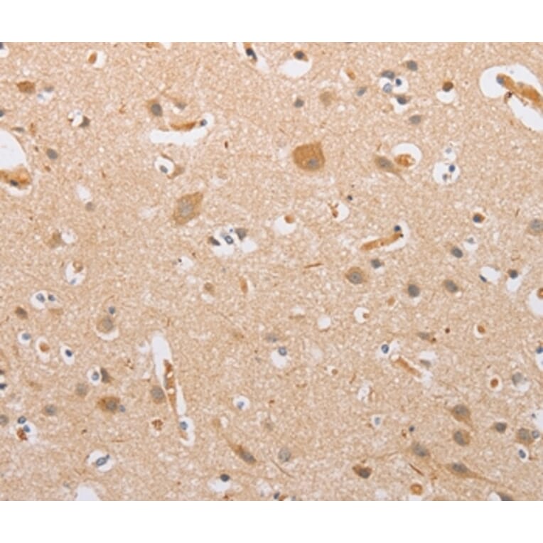 Immunohistochemistry - CSGALNACT2 Antibody from Signalway Antibody (36215) - Antibodies.com