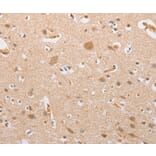 Immunohistochemistry - CSGALNACT2 Antibody from Signalway Antibody (36215) - Antibodies.com