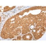 Immunohistochemistry - MKI67/ki67 Antibody from Signalway Antibody (43095) - Antibodies.com
