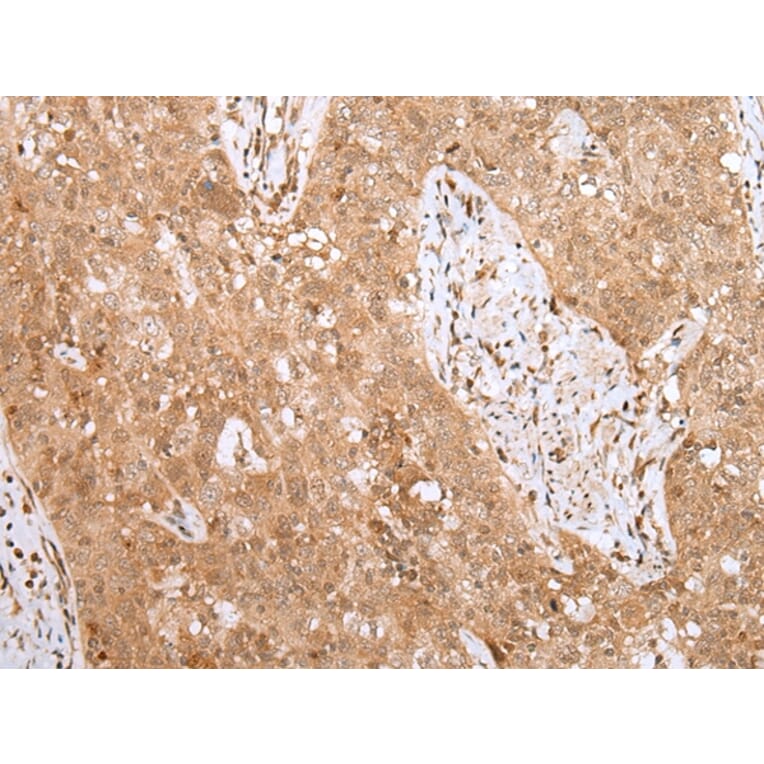 Immunohistochemistry - MKI67/ki67 Antibody from Signalway Antibody (43095) - Antibodies.com