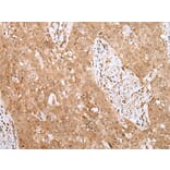 Immunohistochemistry - MKI67/ki67 Antibody from Signalway Antibody (43095) - Antibodies.com