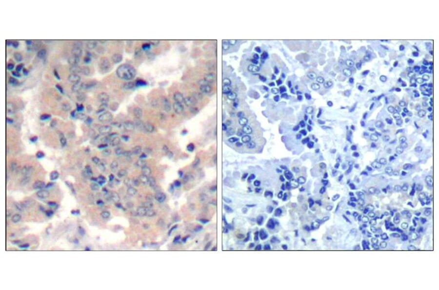 Immunohistochemistry - PI3 Kinase p85/p55 (Ab-467/199) Antibody from Signalway Antibody (21508) - Antibodies.com