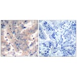 Immunohistochemistry - PI3 Kinase p85/p55 (Ab-467/199) Antibody from Signalway Antibody (21508) - Antibodies.com