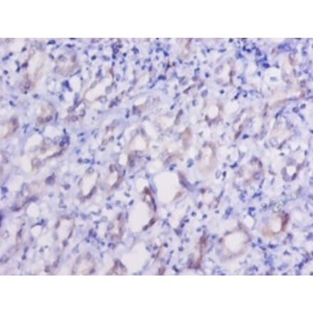 Immunohistochemistry - Elongation factor 2 Polyclonal Antibody from Signalway Antibody (42156) - Antibodies.com
