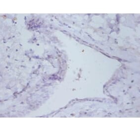 Immunohistochemistry - Prefoldin subunit 5 Polyclonal Antibody from Signalway Antibody (42255) - Antibodies.com