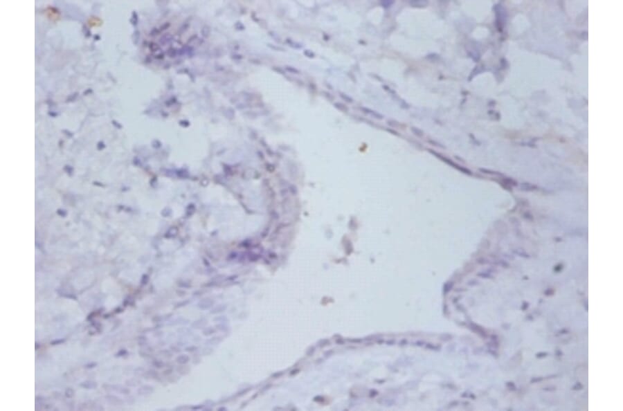 Immunohistochemistry - Prefoldin subunit 5 Polyclonal Antibody from Signalway Antibody (42255) - Antibodies.com