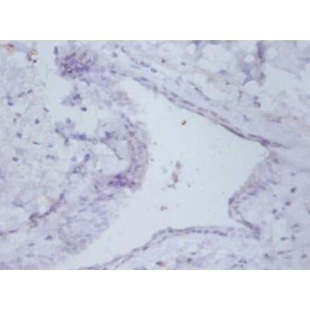 Immunohistochemistry - Prefoldin subunit 5 Polyclonal Antibody from Signalway Antibody (42255) - Antibodies.com