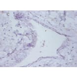 Immunohistochemistry - Prefoldin subunit 5 Polyclonal Antibody from Signalway Antibody (42255) - Antibodies.com
