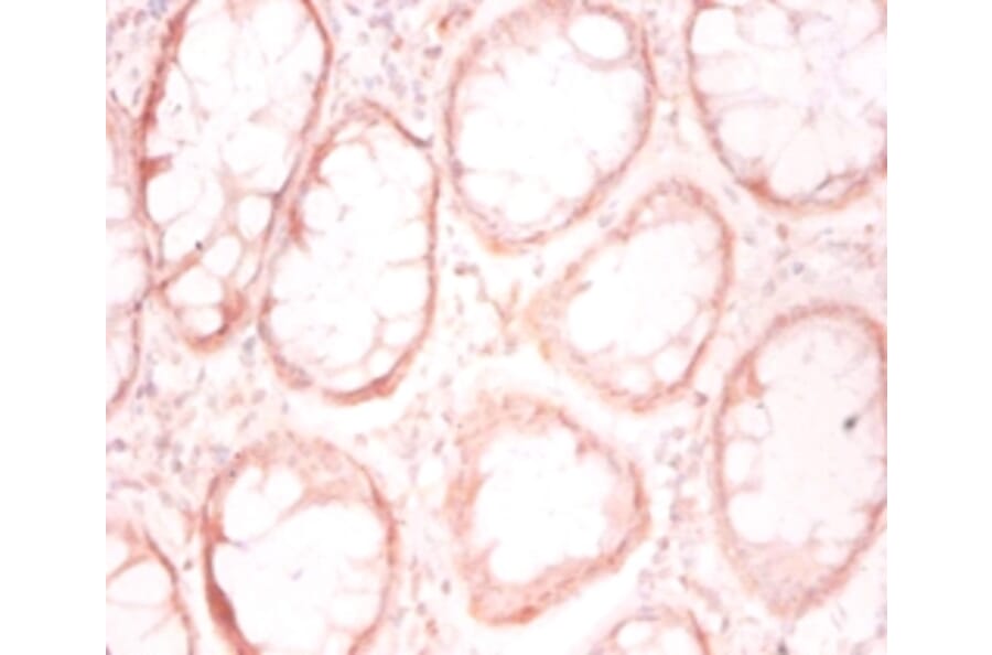 Immunohistochemistry - Prefoldin subunit 1 Polyclonal Antibody from Signalway Antibody (42260) - Antibodies.com