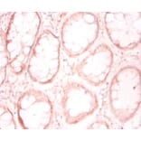 Immunohistochemistry - Prefoldin subunit 1 Polyclonal Antibody from Signalway Antibody (42260) - Antibodies.com