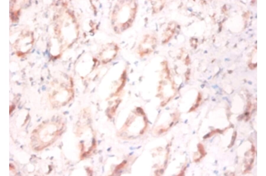 Immunohistochemistry - Prefoldin subunit 1 Polyclonal Antibody from Signalway Antibody (42260) - Antibodies.com