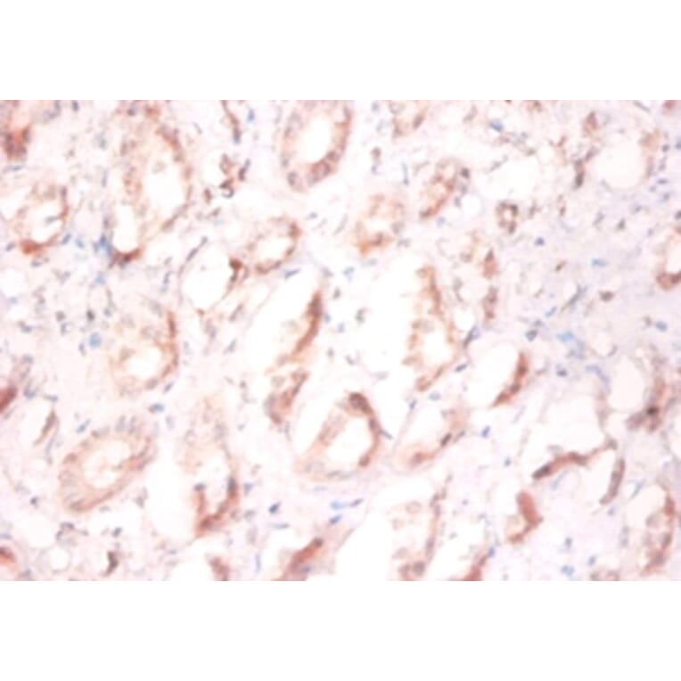 Immunohistochemistry - Prefoldin subunit 1 Polyclonal Antibody from Signalway Antibody (42260) - Antibodies.com