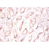 Immunohistochemistry - Prefoldin subunit 1 Polyclonal Antibody from Signalway Antibody (42260) - Antibodies.com