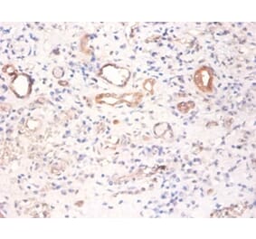 Immunohistochemistry - Pyruvate kinase PKM Polyclonal Antibody from Signalway Antibody (42380) - Antibodies.com