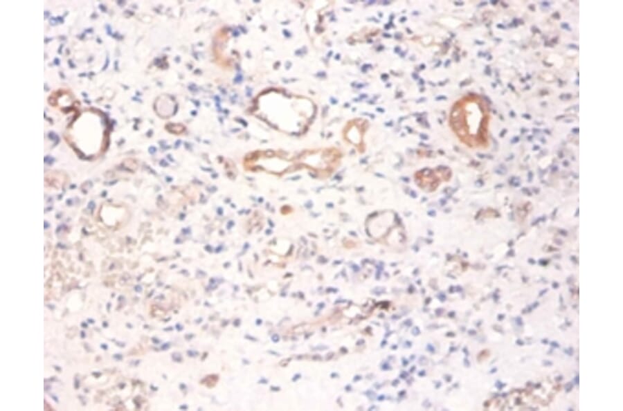 Immunohistochemistry - Pyruvate kinase PKM Polyclonal Antibody from Signalway Antibody (42380) - Antibodies.com