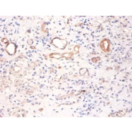 Immunohistochemistry - Pyruvate kinase PKM Polyclonal Antibody from Signalway Antibody (42380) - Antibodies.com