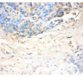 Immunohistochemistry - Antileukoproteinase Polyclonal Antibody from Signalway Antibody (42477) - Antibodies.com