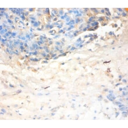 Immunohistochemistry - Antileukoproteinase Polyclonal Antibody from Signalway Antibody (42477) - Antibodies.com