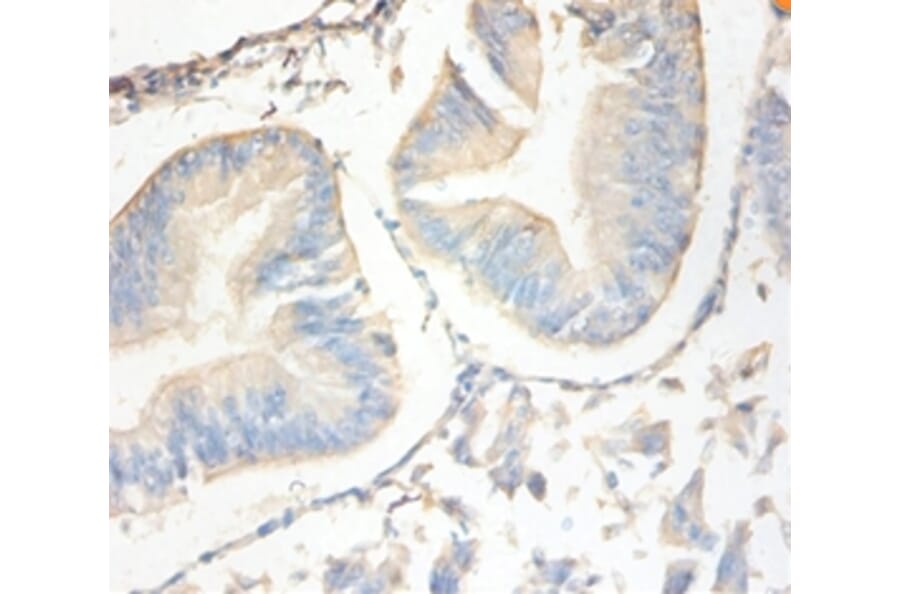 Immunohistochemistry - Antileukoproteinase Polyclonal Antibody from Signalway Antibody (42477) - Antibodies.com