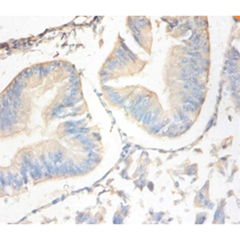 Immunohistochemistry - Antileukoproteinase Polyclonal Antibody from Signalway Antibody (42477) - Antibodies.com