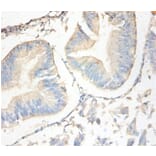 Immunohistochemistry - Antileukoproteinase Polyclonal Antibody from Signalway Antibody (42477) - Antibodies.com