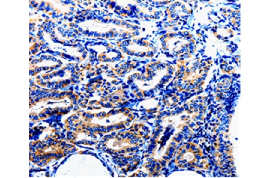 Immunohistochemistry - NFKB1p105 Antibody from Signalway Antibody (35587) - Antibodies.com