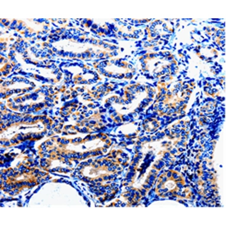 Immunohistochemistry - NFKB1p105 Antibody from Signalway Antibody (35587) - Antibodies.com