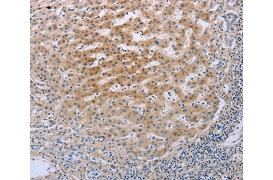 Immunohistochemistry - TNFRSF25 Antibody from Signalway Antibody (35717) - Antibodies.com