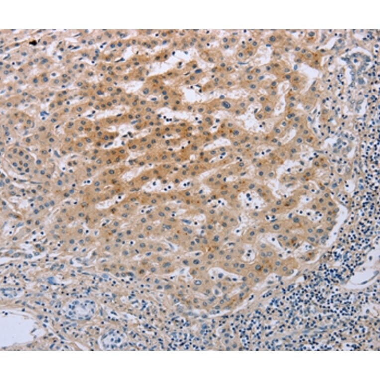 Immunohistochemistry - TNFRSF25 Antibody from Signalway Antibody (35717) - Antibodies.com