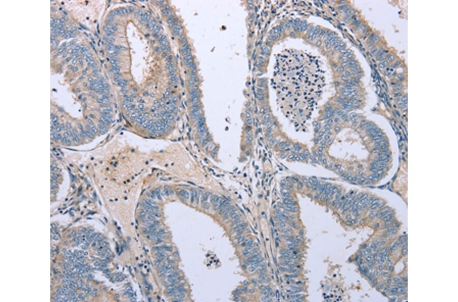 Immunohistochemistry - TNFRSF25 Antibody from Signalway Antibody (35717) - Antibodies.com