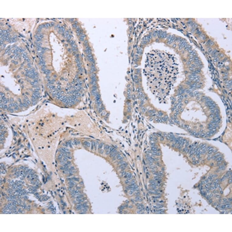 Immunohistochemistry - TNFRSF25 Antibody from Signalway Antibody (35717) - Antibodies.com